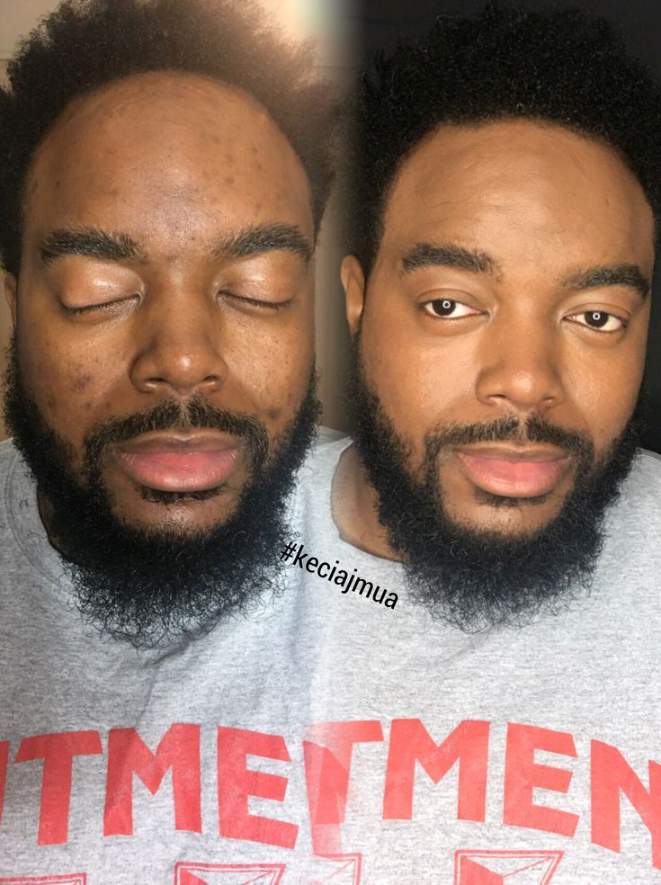 Stick Masque au thé vert - Aide à éliminer les points noirs et à purifier la peau