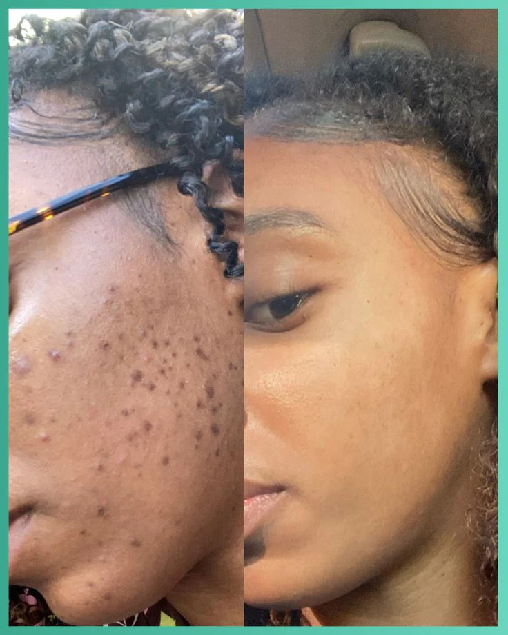 Stick Masque au thé vert - Aide à éliminer les points noirs et à purifier la peau